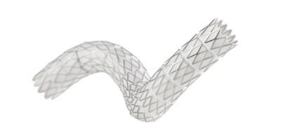 This study aims to compare the GORE VIABAHN VBX Balloon Expandable Endoprosthesis primary patency to bare metal stenting to evaluate superiority in treating complex iliac occlusive disease with the goal of informing practice guidelines around which modality is best suited for patients with this condition