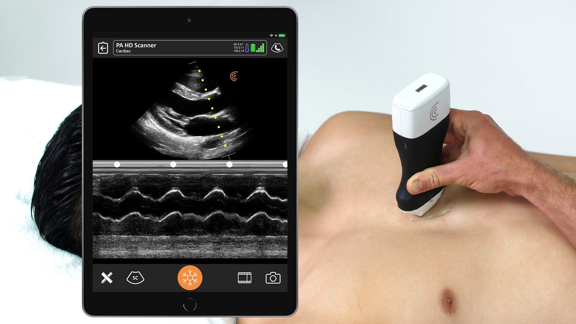 kold Afbrydelse Vurdering High-Definition Handheld Ultrasound Scanner Now Enables Rapid Bedside  Cardiac Exams | DAIC