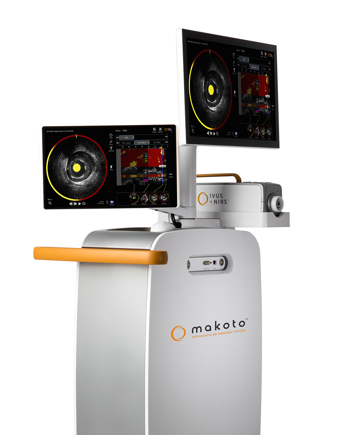 Infraredx Announces Japanese Launch of Makoto Intravascular