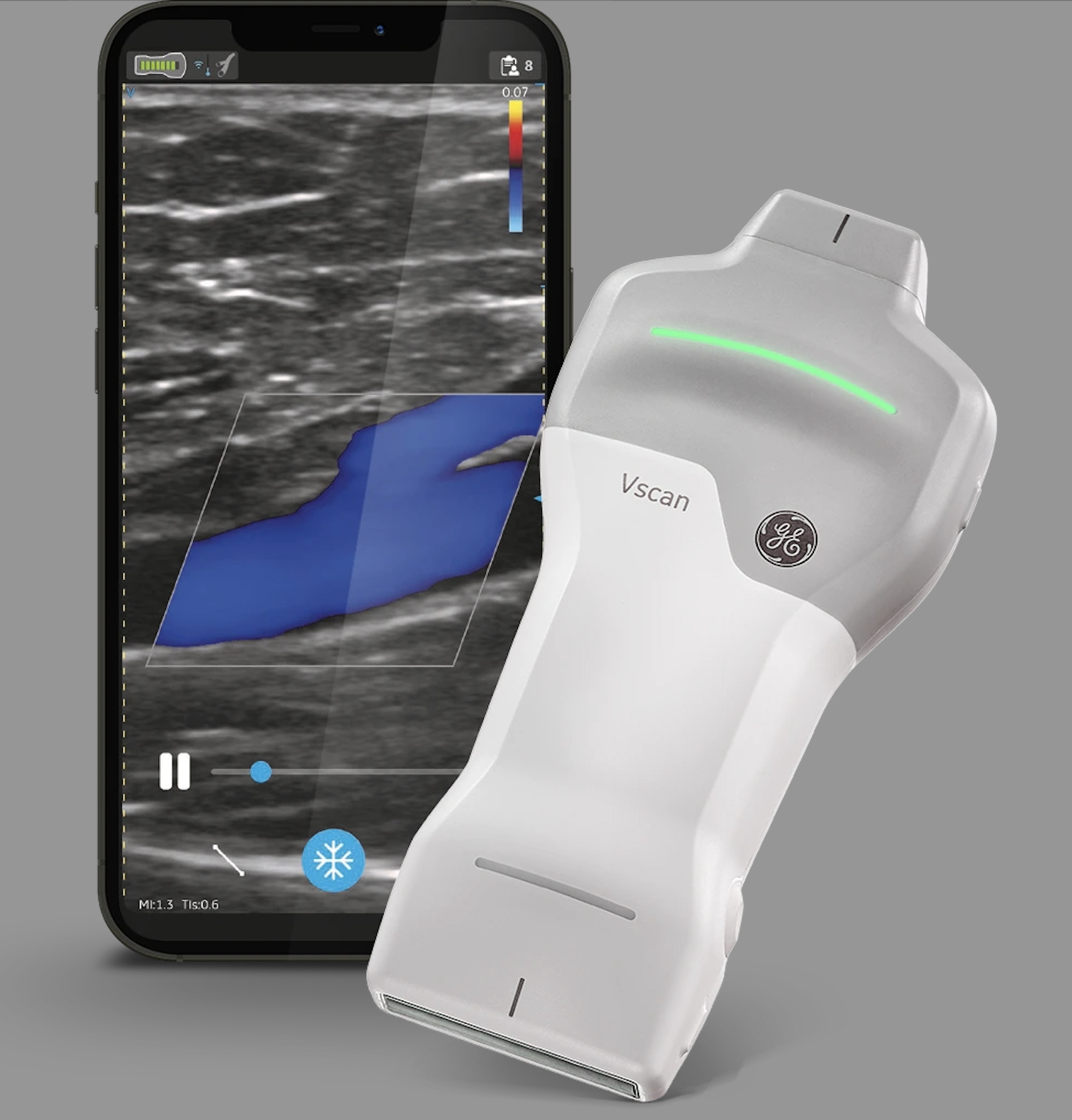 GE HealthCare Introduces Caption AI on Vscan Air SL Wireless 