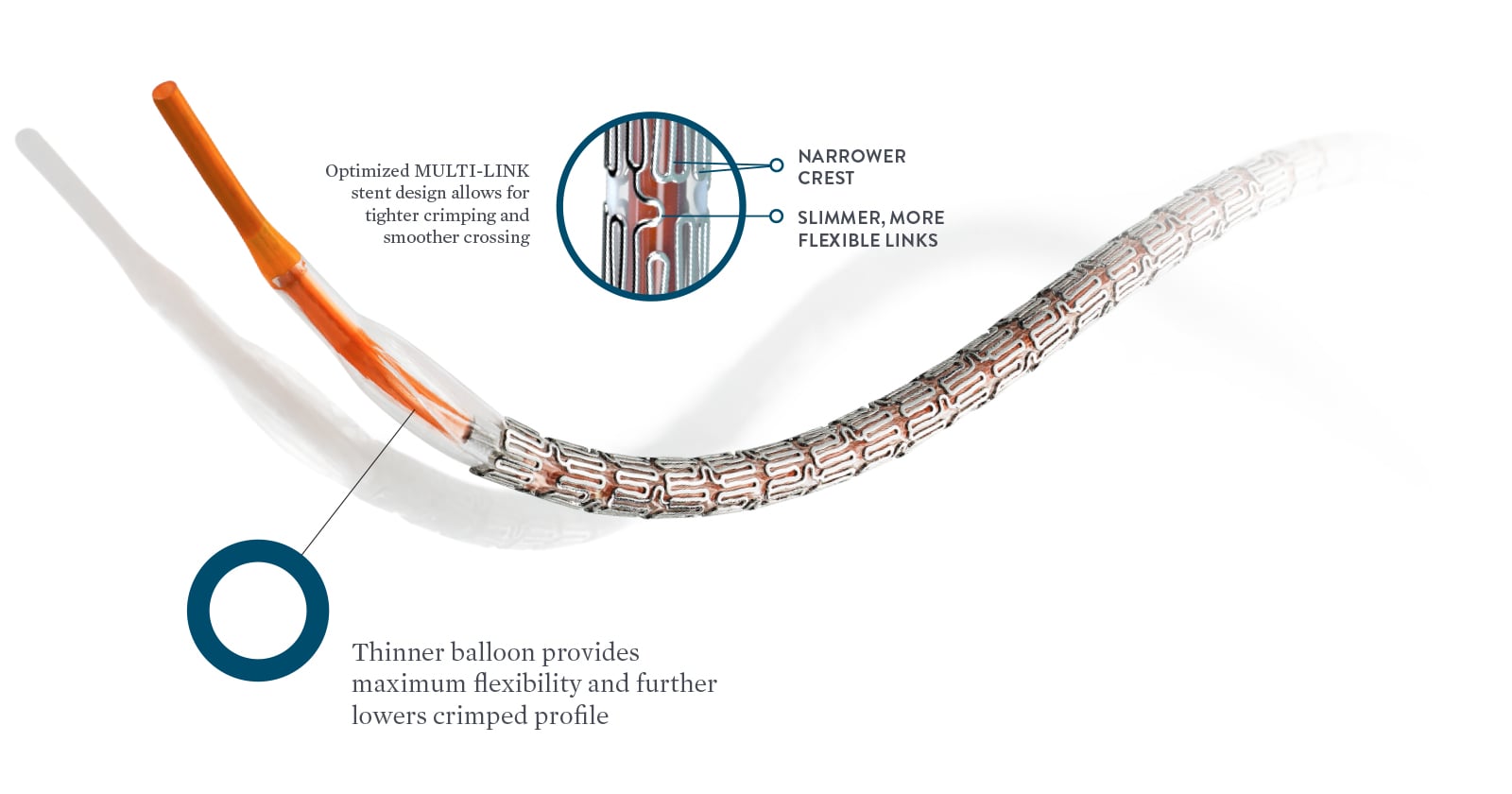 Abbott Gains European Approval for Xience Sierra Stent | DAIC