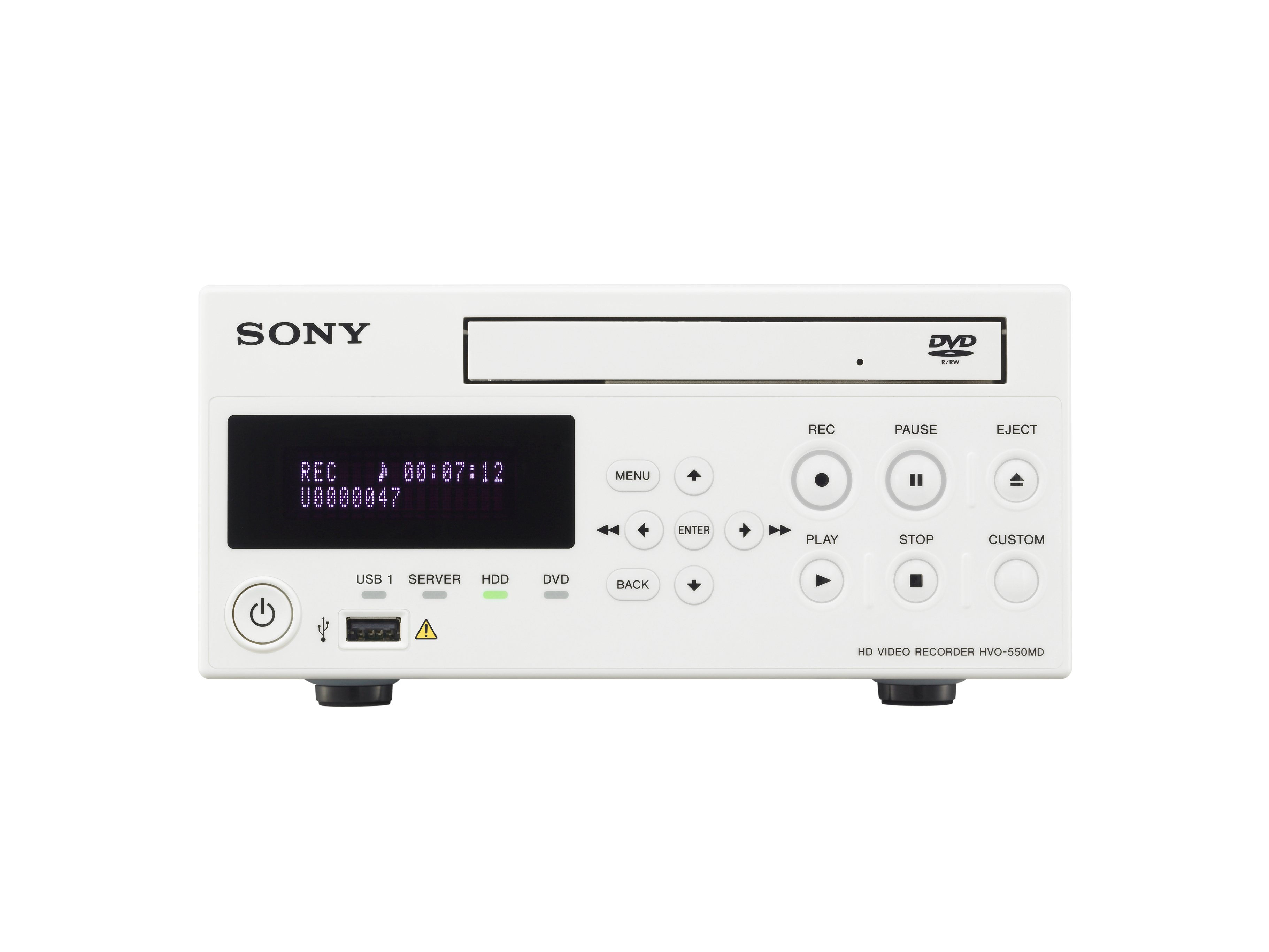 Sony Medical Introduces HVO-500MD and HVO550MD HD Ultrasound