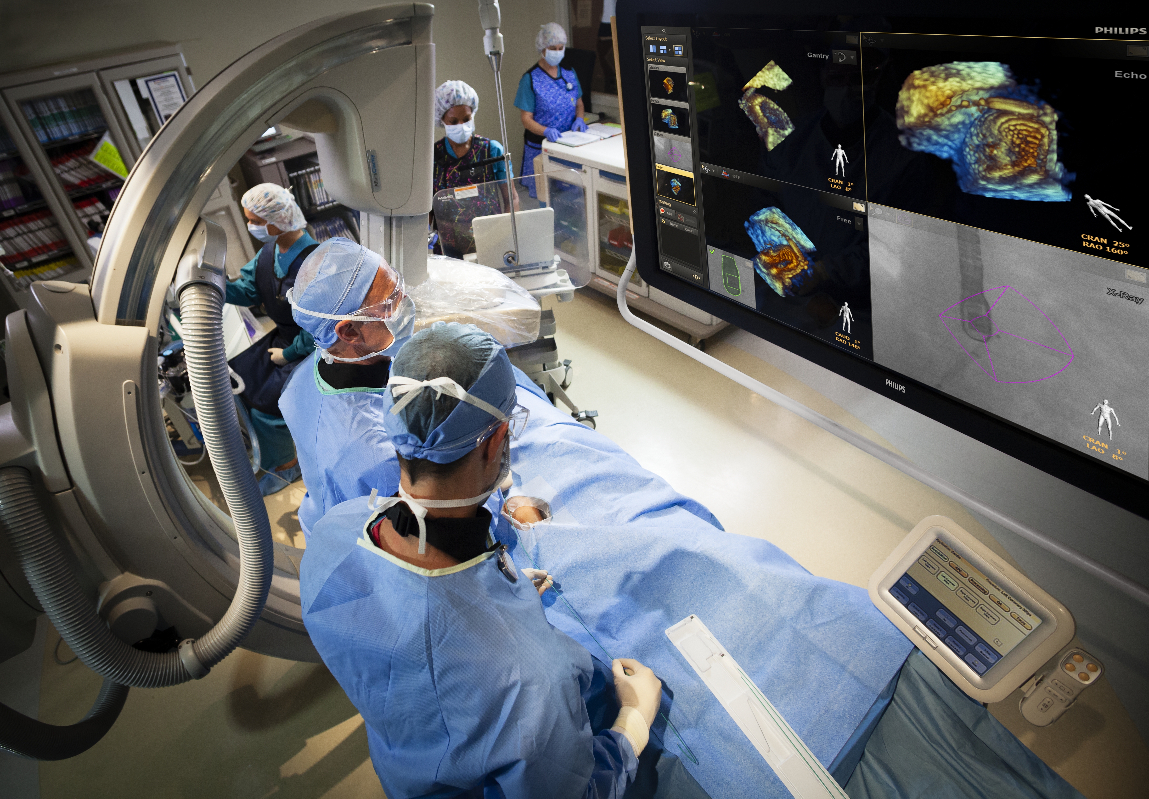 Advances in Transesophageal Echo | DAIC