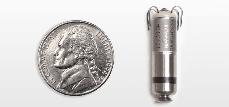 The Abbott Micra leadless, single chamber pacemaker.