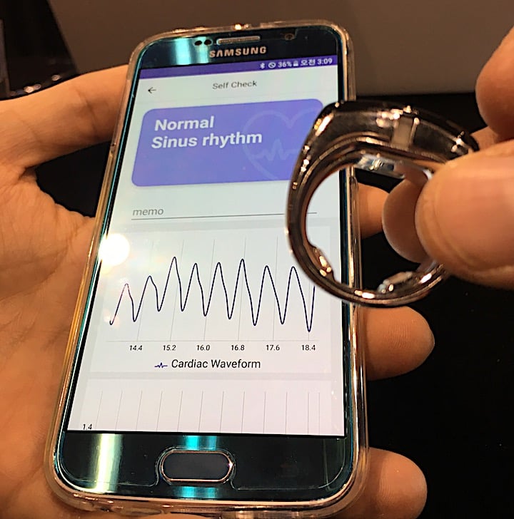 An example of a wearable cardiac tracking device offered by the vendor Sky Lab displayed at the American heart Association (AHA) 2018 meeting. It is worn like a normal ring on a finger and interfaces with a smartphone app via a wireless Bluetooth connection to track ECG readings and alert a patient if an arrhythmia is detected. Photo by Dave Fornell. 