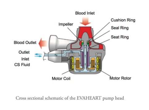 The EvaHeart2 LVAD system
