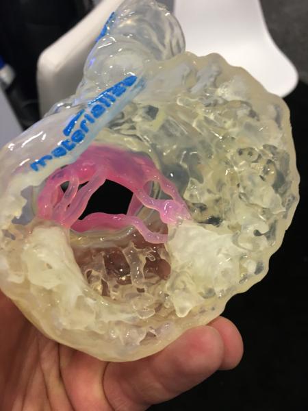 A 3-D printed heart from a patient CT scan used for structural heart procedure planning and education displayed by Materialise.#TCT2019 #TCT #TCT19