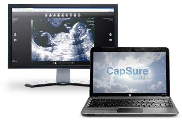 GlobalMed CapSure Cloud CT Systems Radiation Dose Management Clinical Decision