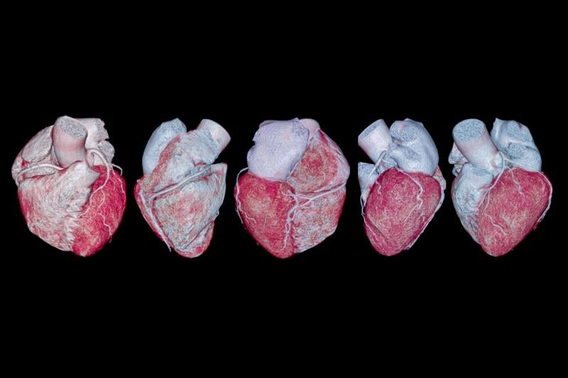 Cardiac CT isn't just a diagnostic tool — it's an essential component of cardiovascular health