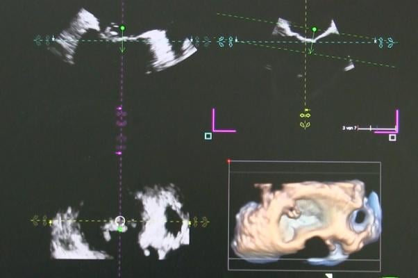 ASE Participating in Global Study to Establish New Standardization in Cardiovascular Ultrasound