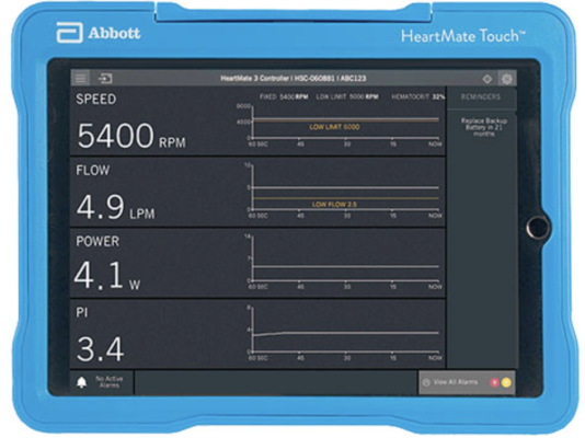 The U.S. Food and Drug Administration (FDA) announced that Abbott is recalling its HeartMate Touch System (version 1.0.32) for risk of unexpected pump stop or start. Issues may occur if the HeartMate Touch System is disconnected from a patient’s HeartMate Controller while a “pump stop” command is running. People who have the implantable HeartMate 3 Left Ventricular Assist Device may be affected.