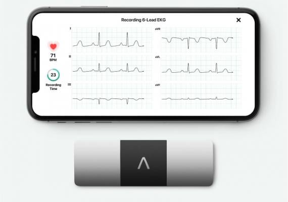 FDA Clears AliveCor's KardiaMobile 6L as First Six-Lead Personal ECG Device