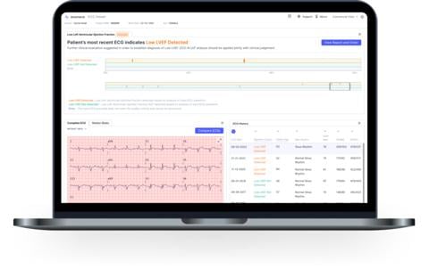 Based on pioneering research from Mayo Clinic, ECG-AI LEF aims to aid physicians in identifying low ejection fraction in patients at risk of heart failure 