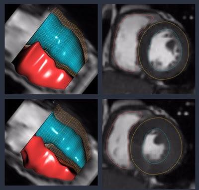 Arterys Demonstrates AI Cloud-Based Medical Image Analysis Solutions at RSNA 2018