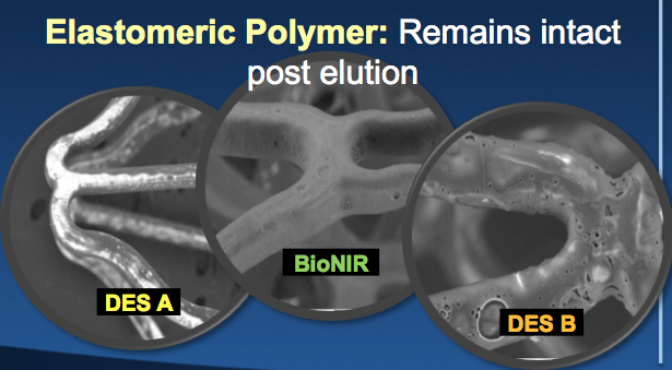 Bionics trial, Medinol, BioNIR stent, elastic polymer