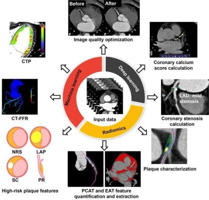 The application of AI technology in the diagnosis of cardiovascular diseases using coronary CT angiography (CCTA) has gradually deepened
