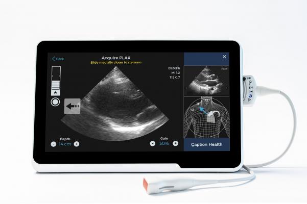 The FDA granted marketing authorization of the Caption Guidance software to Caption Health Inc. in February 2020. It uses artificial intelligence to guide users to get optimal cardiac ultrasound images in a point of care ultrasound (POCUS) setting.