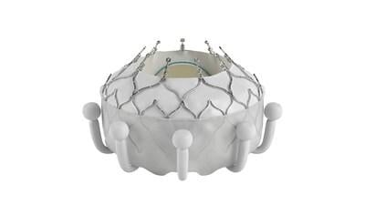 Edwards Lifesciences Corporation announced the company's EVOQUE tricuspid valve replacement system received CE Mark for the transcatheter treatment of eligible patients with tricuspid regurgitation 