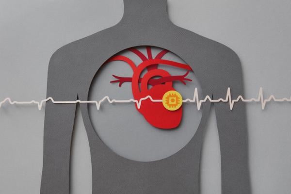 Acutus Medical, Inc., an arrhythmia management company focused on improving the way cardiac arrhythmias are diagnosed and treated, announced results from the RECOVER AF study. 