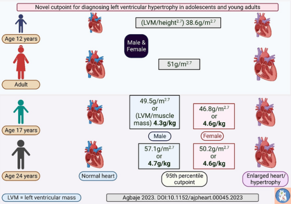 The three-decade-old international cutpoint for diagnosing children and adolescents with an enlarged heart misclassifies normal heart size as cardiac damage in adolescents, a paper published in the American Journal of Physiology-Heart and Circulatory Physiology concludes 