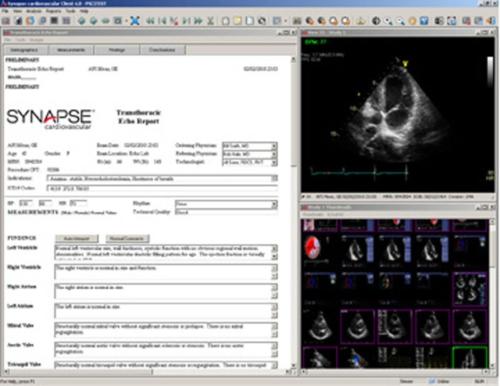 Synapse Cardiovascular 5.0 FujiFilm Medical Systems USA RSNA 2012 Cardiac PACS