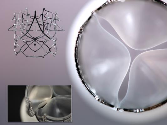 DSM and SAT Partnering to Develop Next-Generation, Cost-Effective Heart Valve