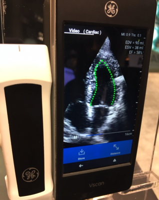 DiA’s novel solution leverages AI to transform the way clinicians capture and analyze ultrasound images