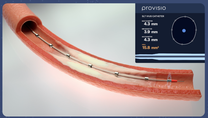 Groundbreaking technology for the precise, automatic measurement of peripheral blood vessels to optimize treatment strategies