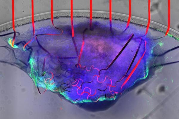A bioelectronic mesh, studded with graphene sensors (red), can measure the electrical signal and movement  of cardiac tissue (purple and green) at the same time.