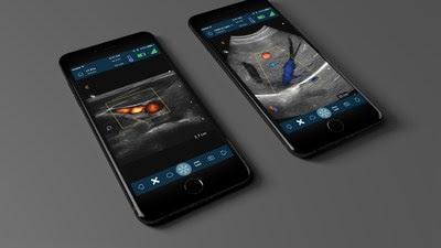 Clarius Wireless Ultrasound Scanners Now Available With Advanced Features