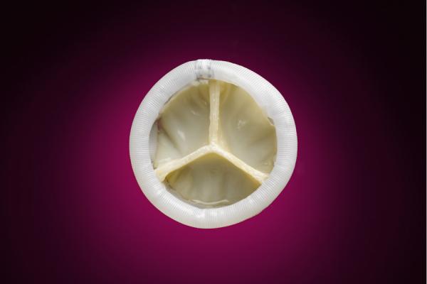 Direct Flow Medical, Transcatheter Aortic Valve System, DISCOVER, EuroPCR