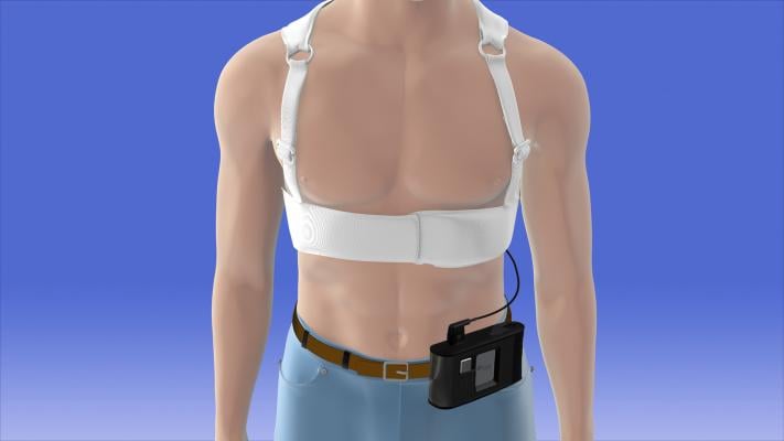 zoll, lifevest, wearable defibrillator