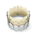 The Sapien will likely become the first transcatheter aortic valve cleared for use in the United States. However, its use will likely be limited to a small number of specialized centers. It is used for transcatheter aortic valve replacement (TAVR), also called implantation, or TAVI.