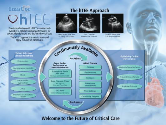 hTEE 24/7 Clinical Support Program ImaCor 