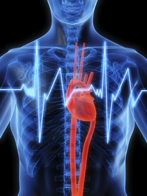 defibrillator, heart study