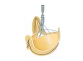 Sorin Group, heart valve repair, first implant