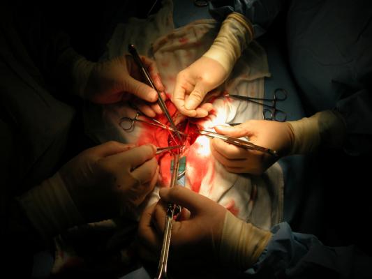 CTSN, atrial fibrillation, surgical ablation, mitral valve surgery