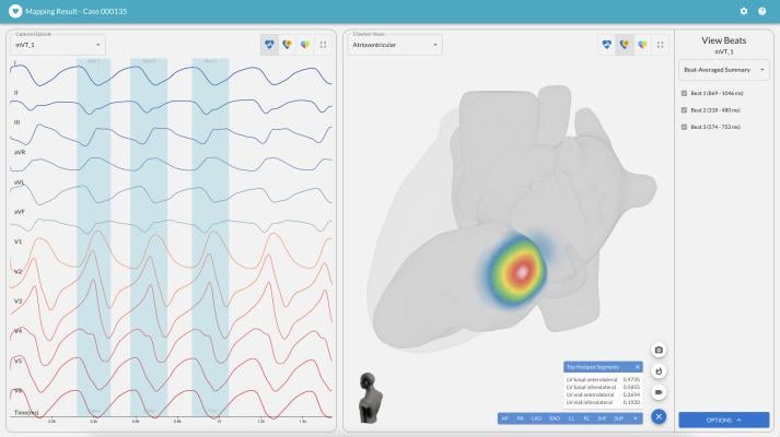 Updated AI-based software is designed to improve cardiac ablation outcomes and procedural efficiencies 