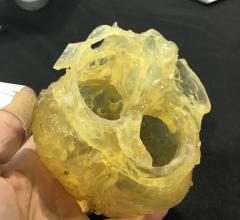 The use of 3-D printed hearts from patients' pre-TAVR planning CT scans have improved outcomes of procedures at the University of Minnesota. Clearly identifying where calcium is located on the valves prior to TAVR device implantation has helped reduce the incidence of paravalvular leak.  #SCAI, #SCAI2018