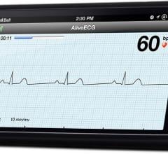 AliveCor AliveECG App Heart Monitor ECG Wireless Remote Access Mobile Device