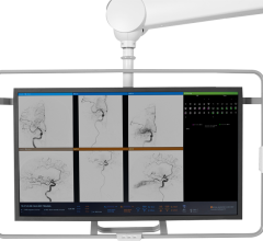 AngioFlow by RapidAI will facilitate confident clinical decision-making immediately prior to or after neuro-interventional procedures