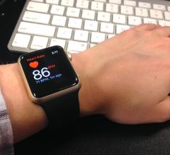 The Apple Watch Series 2, Samsung Galaxy Gear S3 and the Fitbit Charge 2 were all able to properly diagnose the very rapid heart beats involved in  paroxysmal supraventricular tachycardia (PSVT). #HRS2018 