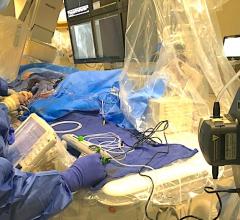 A CSI Diamondabck 360 atheretectomy system in use during a cath lab procedure at Henry Ford Hospital in Detroit. Photo by Dave Fornell