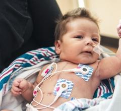 Stem Cell Therapy May Offer Treatment for Rare Congenital Cardiac Defect