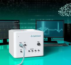 ECGenius sets a new standard for ECG signal detection, interpretation and therapy support