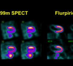 rsna 2013 radiopharmaceuticals tracers nuclear imaging trial study flurpiridaz