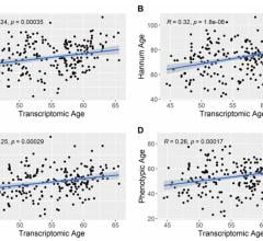 Correlation between transcriptomic age and other epigenetic aging predictors