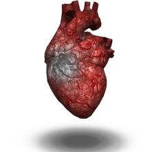 Immune response and the lymphatic system are central to cardiac repair after a heart attack, according to a study from Ann & Robert H. Lurie Children’s Hospital of Chicago and Northwestern University Feinberg Cardiovascular Research Institute. 