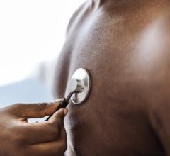 Nationwide study points to implicit bias in treatment of cardiovascular disease for non-Hispanic Black patients and highlights need for equity