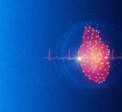 Patent covers use of AI-ECG for any echo measure of diastolic function, which is crucial for heart screening and early detection of heart disease
